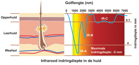 Nobel infraroodstraling